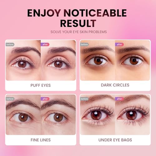 AILEORY Under Eye Patches (24 Pairs) - Tri-color Glitter Eye Gel - Product Imagery