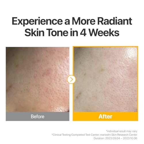 numbuzin No.5 Sheet Mask | Vitamin Spotlight Sheet Mask | - Product Imagery