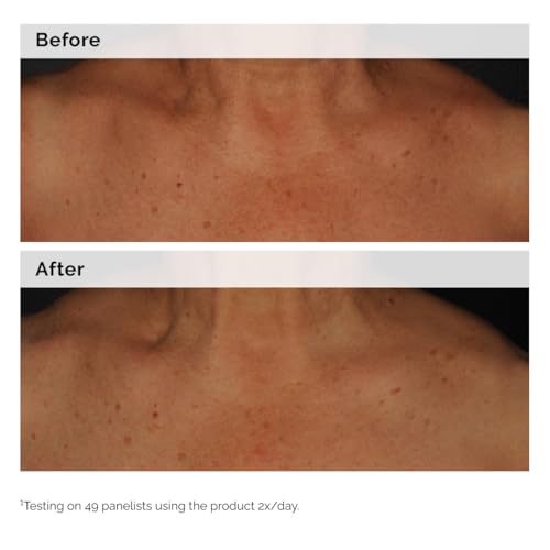 The Ordinary Niacinamide 5% Face and Body Emulsion, Dark Spot & - Product Imagery