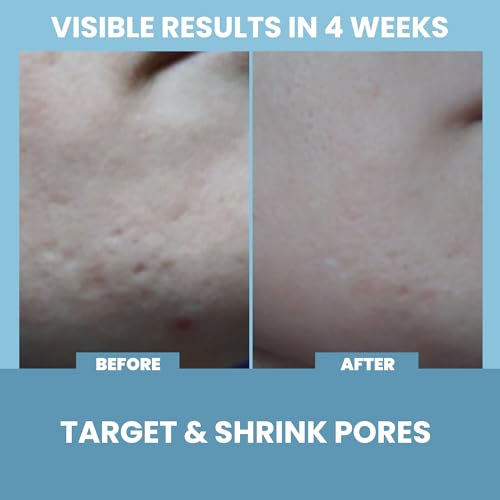 Eva Naturals Niacinamide 5% Serum, Hyaluronic Acid, Vitamin E & - Product Imagery