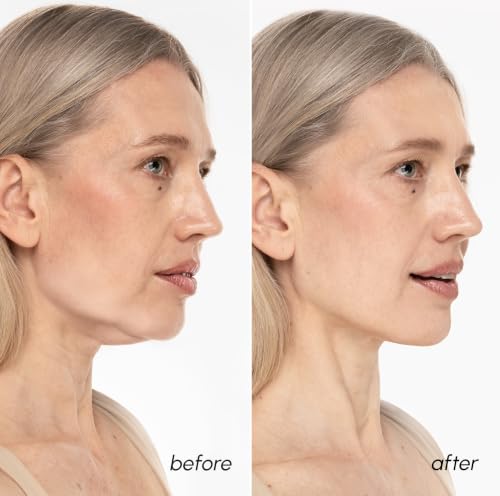 MAREE V Line Lifting Mask with 24K Gold – Deep Collagen Face - Product Imagery