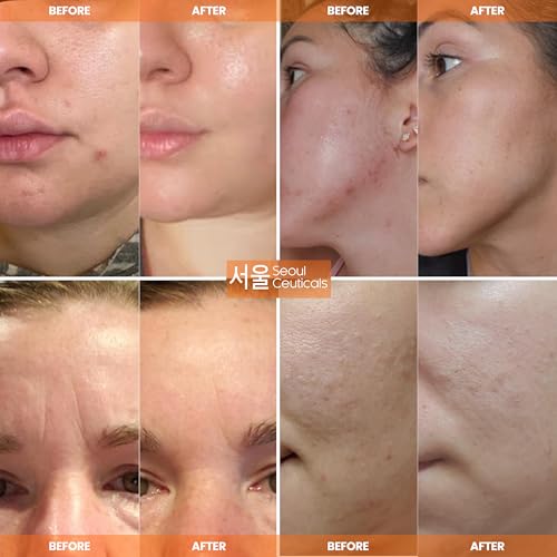 SeoulCeuticals 97.5% Snail Mucin Korean Face Moisturizer Day & - Product Imagery