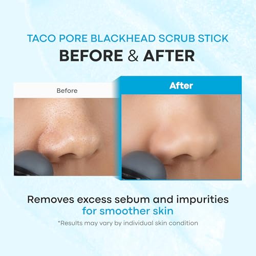 TONYMOLY Tako Pore Clay Scrub Stick, Korean Blackhead - Product Imagery