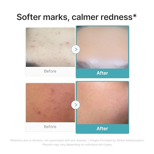 medicube Azelaic Acid 10 Soothing Serum - Product Imagery
