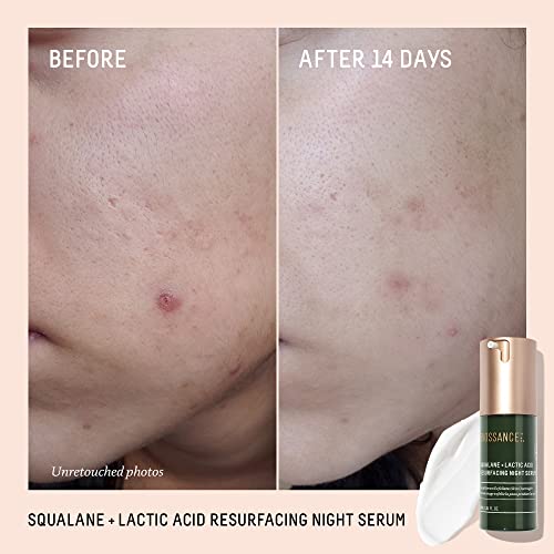 BIOSSANCE Rapid Radiance Set - Clean Skincare Gift for Glowing - Product Imagery