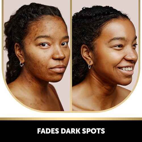 VALITIC Kojic Acid Soap for Hyperpigmentation with Turmeric 2 - Product Imagery