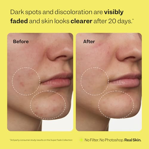 Peach Slices - Super Fade Discoloration Serum for Face (1.01 oz) - Product Imagery