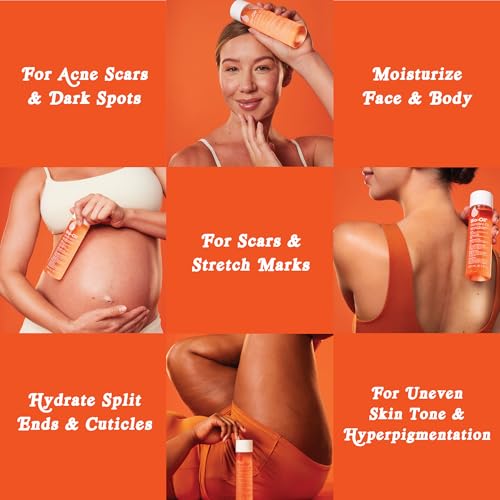 Bio-Oil Skincare Body Oil Serum, Scars & Stretch Marks, 6.7 fl oz - Product Imagery
