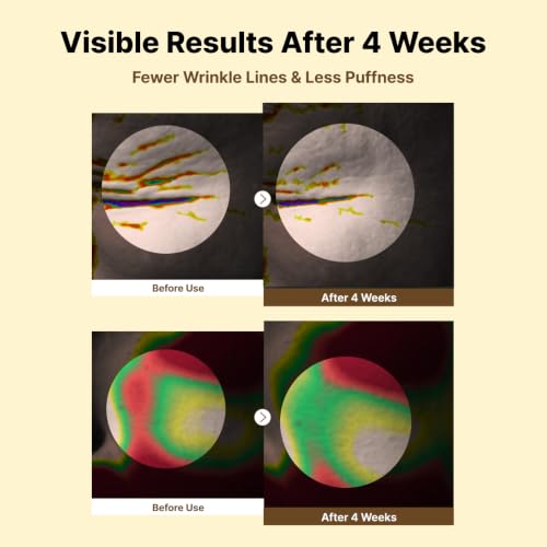 NIDA Revive Eye Cream For Face And Neck | Probiotics Lystate - Product Imagery