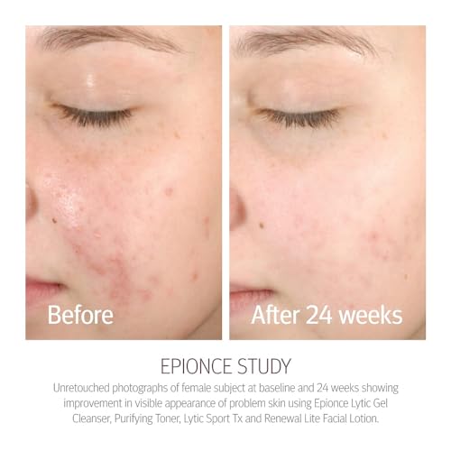 Epionce Renewal Lite Facial Lotion Lightweight Anti-Aging Face - Product Imagery