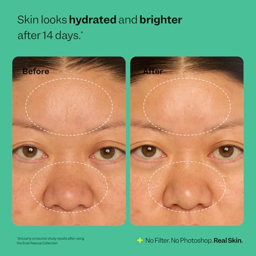 Peach Slices - Snail Rescue All-in-One Oil Free Moisturizer - Product Imagery