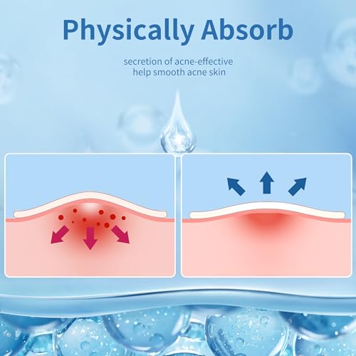 Daolyo Pimple Patches for Face, 4 Size 300 Counts Hydrocolloid - Product Imagery