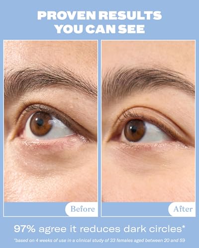 Then I Met You Snail Mucin Eye Cream, Korean Skin Care With - Product Imagery