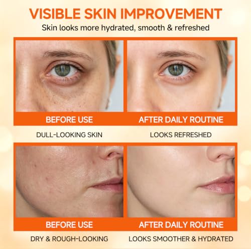Vitamin C Niacinamide Skincare Set, Daily Facial Care Routine - Product Imagery