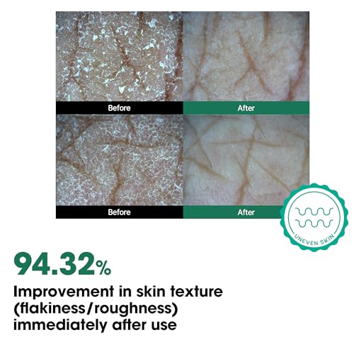 SOME BY MI AHA BHA PHA 30 Days Miracle Body Toner Mist – 4.73oz, - Product Imagery
