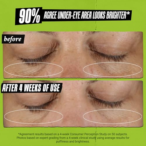 Kiehl's - Avocado Eye Treatment, for Dry Lines & Puffiness - Product Imagery