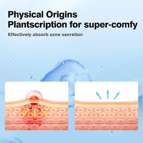 QUSTERE Pimple Patches for Face, Hydrocolloid Acne Patches, Cute - Product Imagery