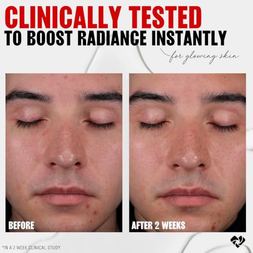 Thayers 2% AHA Exfoliating and Brightening Toner with Glycolic - Product Imagery