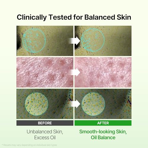 DERMA FACTORY Niacinamide 20% Face Serum for Oily Skin, Pore Care - Product Imagery