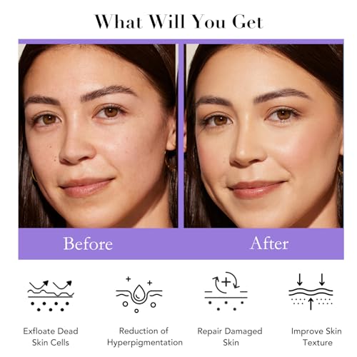 Daily Essential Skincare Set, Glycolic Acid+Vitamin C Facial - Product Imagery