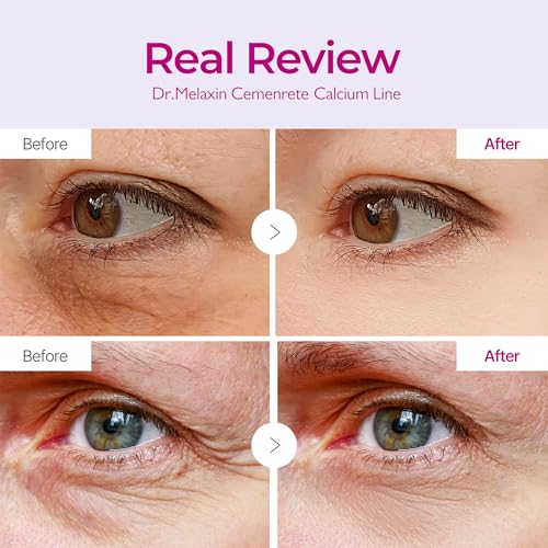 n Calcium Volume Under Eye Patches for Puffy Eyes & Dark - Product Imagery