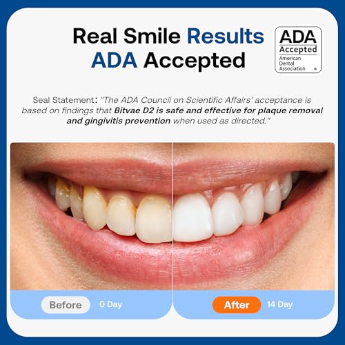 Bitvae ADA Accepted Electric Toothbrush, 60-Day Battery Travel - Product Imagery