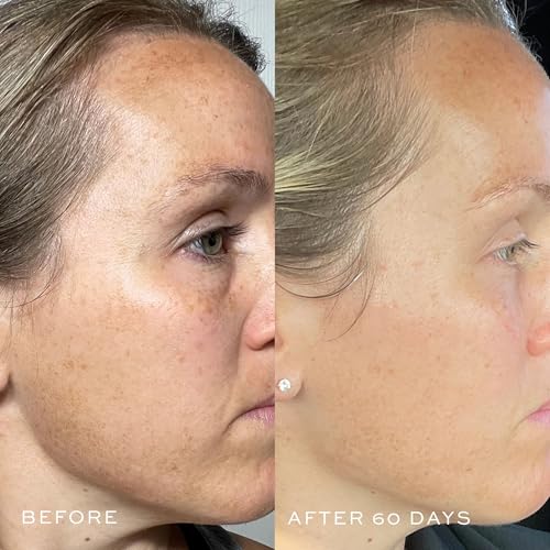DIME Beauty TBT Serum - Anti-Aging Face Serum, 1 oz - Product Imagery