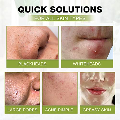 Blackhead Peel Off Face Mask, SHVYOG 3-in-1 Blackhead Remover - Product Imagery