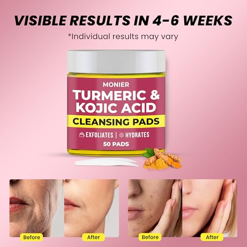 Turmeric Kojic Acid Cleansing Pads for Face Dark Spots - - Product Imagery