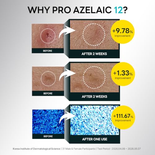 ROUND LAB Azelaic Acid 12 Soothing Serum, 1.01 Fl Oz - Product Imagery