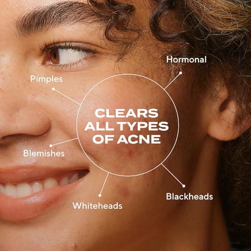 Murad Biome-Balancing Acne Serum - Mandelic & Salicylic Acid - 1 - Product Imagery
