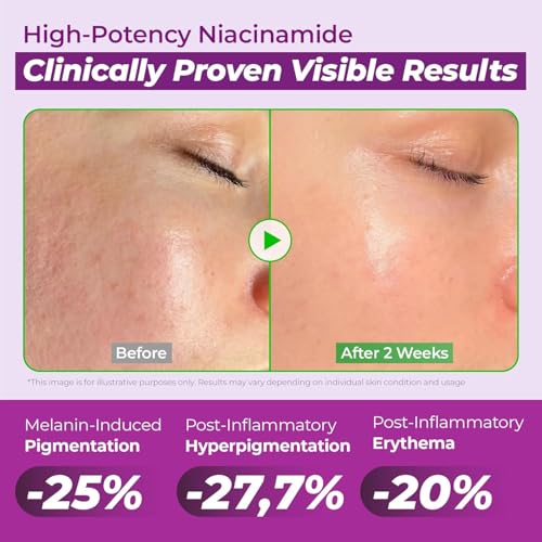 JUMISO 20% Niacinamide Dark Spot Correcting Serum for Face, 1.35 - Product Imagery