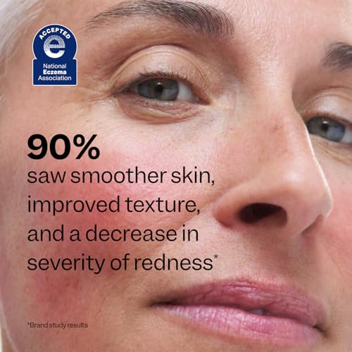 Peach Slices - Redness Relief 10% Azelaic Acid Serum (1.01 oz) - - Product Imagery