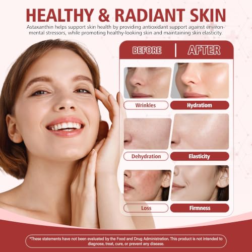 Astaxanthin 12mg Supplement, 180 Softgels, 6 Month Supply - Product Imagery