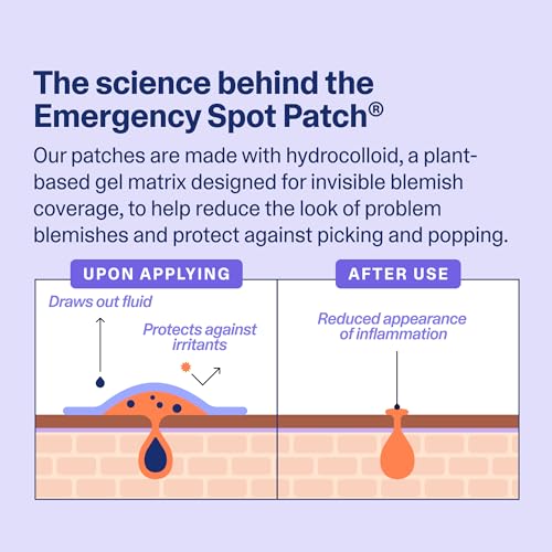 Curology Clear Pimple Patches for Face, Hydrocolloid Acne Spot - Product Imagery