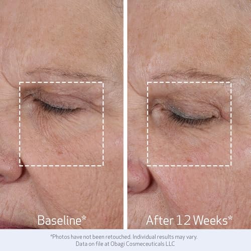 Obagi ELASTIderm Lift Up & Sculpt Facial Moisturizer – - Product Imagery