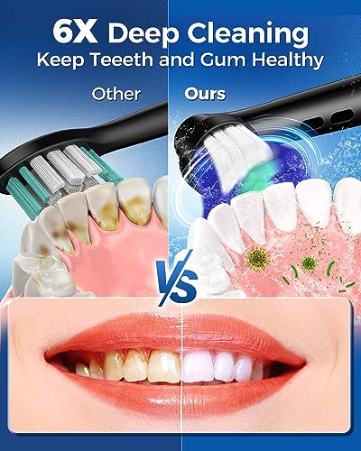 Rotating Electric Toothbrush for Adults, 8 Heads 2 Types, 4 - Product Imagery