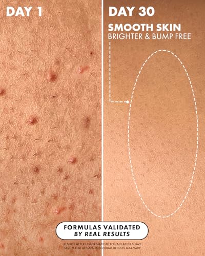 Truly Beauty Smooth Legend After Shave Serum | Reduce Bumps & KP - Product Imagery