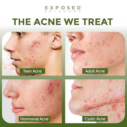 Exposed Skin Care Moisture Complex Oil-Free Daily Face - Product Imagery
