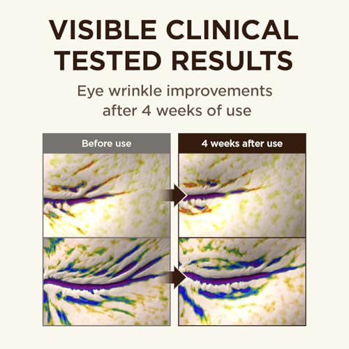 CKD Retinal Lifting Bundle – 5X Gua Sha Eye Cream + Retinol - Product Imagery