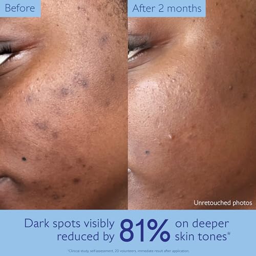 Caudalie Vinoperfect Brightening Dark Spot Serum Vitamin C - Product Imagery