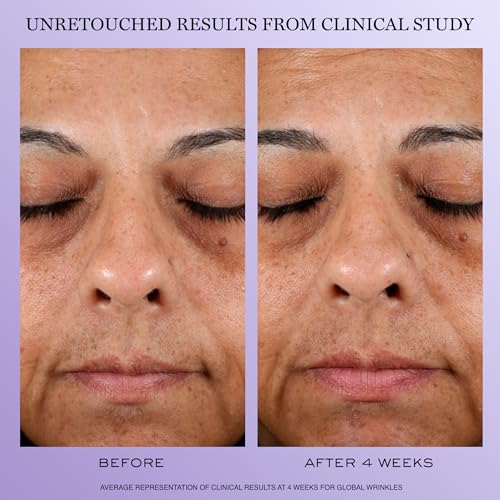 Lancôme - Rénergie H.P.N. 300-Peptide Anti-Aging Face Cream 1.7 - Product Imagery