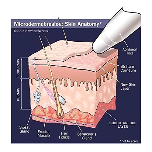 NeedCrystals Microdermabrasion Crystals for Machines, - Product Imagery