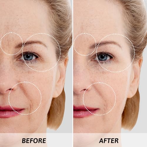 Mother's Day Gifts for Mom Skin Care Routine Kit for Women, Rose - Product Imagery