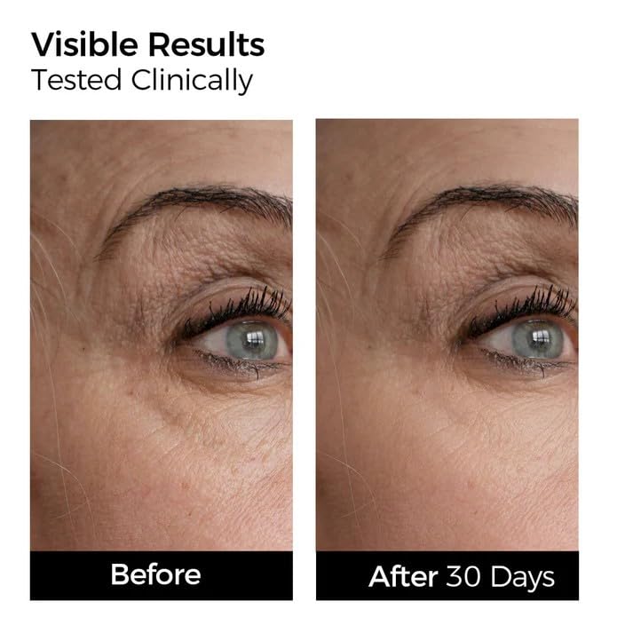 WNP Hydrating Repair Serum Set: 3% Hyaluronic Acid & Collagen, - Product Imagery