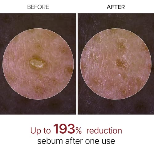 n Peel Shot Glow White Rice Peeling Ampoule with Rice Extract & - Product Imagery