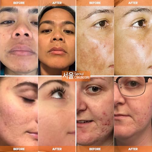 SeoulCeuticals Korean Skin Care 20% Vitamin C Serum for Face + - Product Imagery