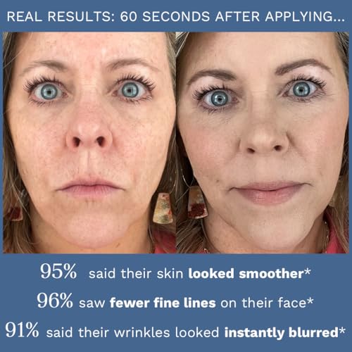 City Beauty Line-Blurring Wrinkle Filler – Spot Solution for - Product Imagery