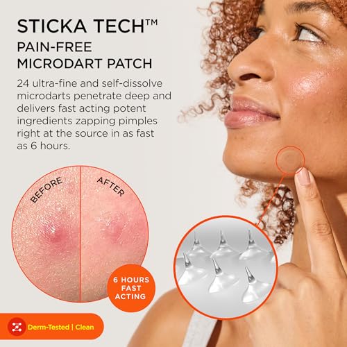 ZitSticka Killa Kit Microdart Pimple Patch For Face, - Product Imagery