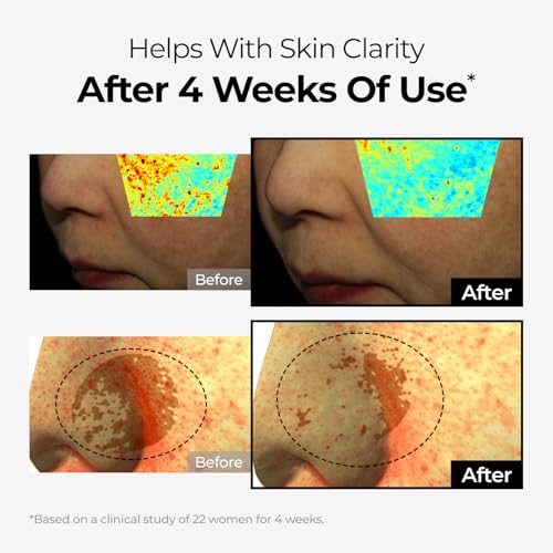 DOMINAS TXA Spot Corrector Cream 1.76 oz - Visibly Reduce Age & - Product Imagery
